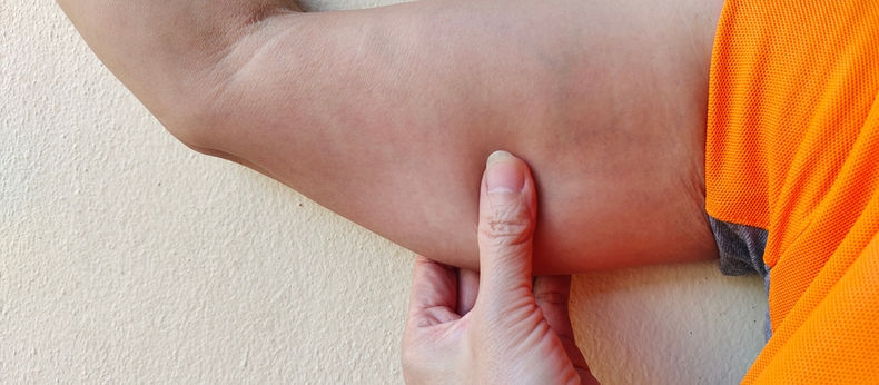 Dubai's Arm Lift Surgery: Is It Worth the Hype? Pros and Cons Revealed