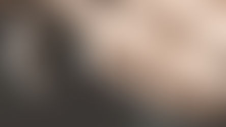 CIRURGIA DE ATM COM PRÓTESE PERSONALIZADA: JUSTIÇA OBRIGA PLANO DE SAÚDE A CUSTEAR 