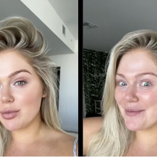 Are Filters on TikTok causing psychological distress?