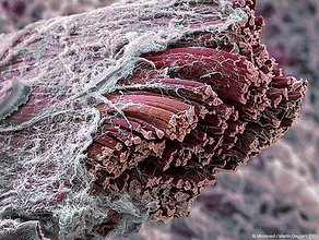 gross anatomy skeletal muscle