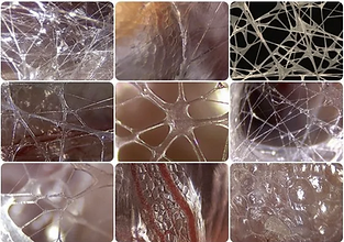 fascia tissue
