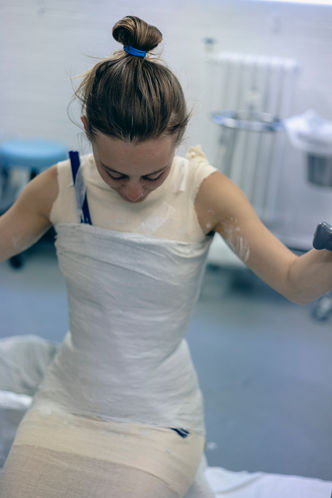 [2023] Imogen Wilde (Eimear) being fitted for a custom Boston back brace by the Ortholese team.