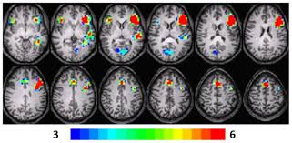https://www.google.com/url?sa=i&source=images&cd=&ved=2ahUKEwjGrcOo-LrlAhVHo54KHaj7AOwQjRx6BAgBEAQ&url=https%3A%2F%2Fwww.researchgate.net%2Ffigure%2FComposite-fMRI-activation-maps-for-the-verb-generation-verb-generationfinger-tapping_fig3_263740855&psig=AOvVaw3tH1CsdOZgYJAIxhwbZBn1&ust=1572214164067091