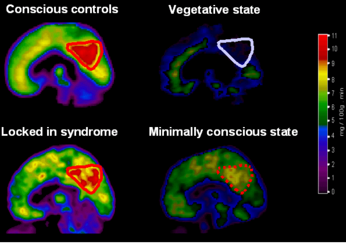 https://upload.wikimedia.org/wikipedia/en/0/0d/Neurowiki_1.GIF