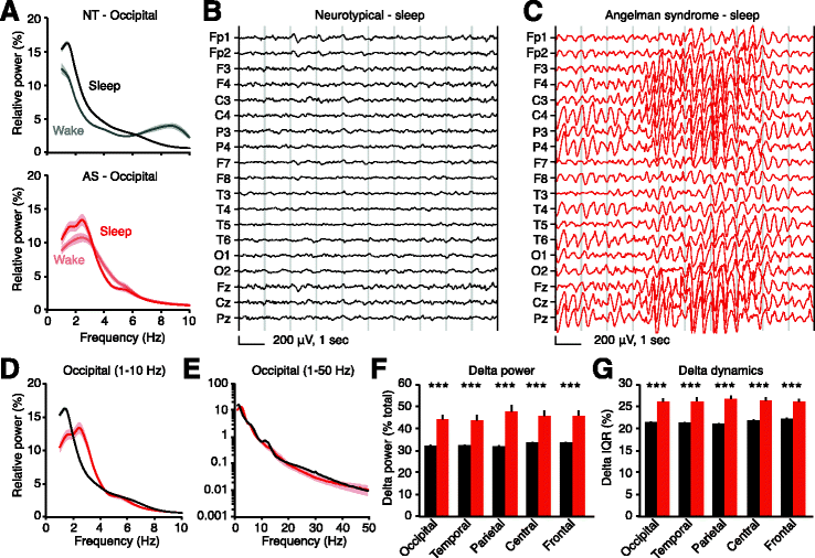 https://media.springernature.com/lw785/springer-static/image/art%3A10.1186%2Fs11689-017-9195-8/MediaObjects/11689_2017_9195_Fig4_HTML.gif