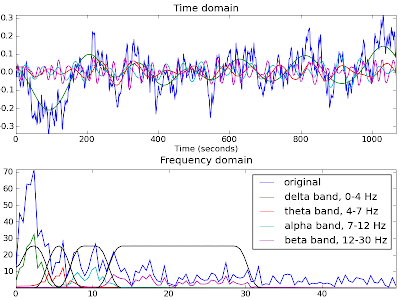 Image from: http://forrestbao.blogspot.com/2009/10/eeg-signal-processing-in-python-and.html