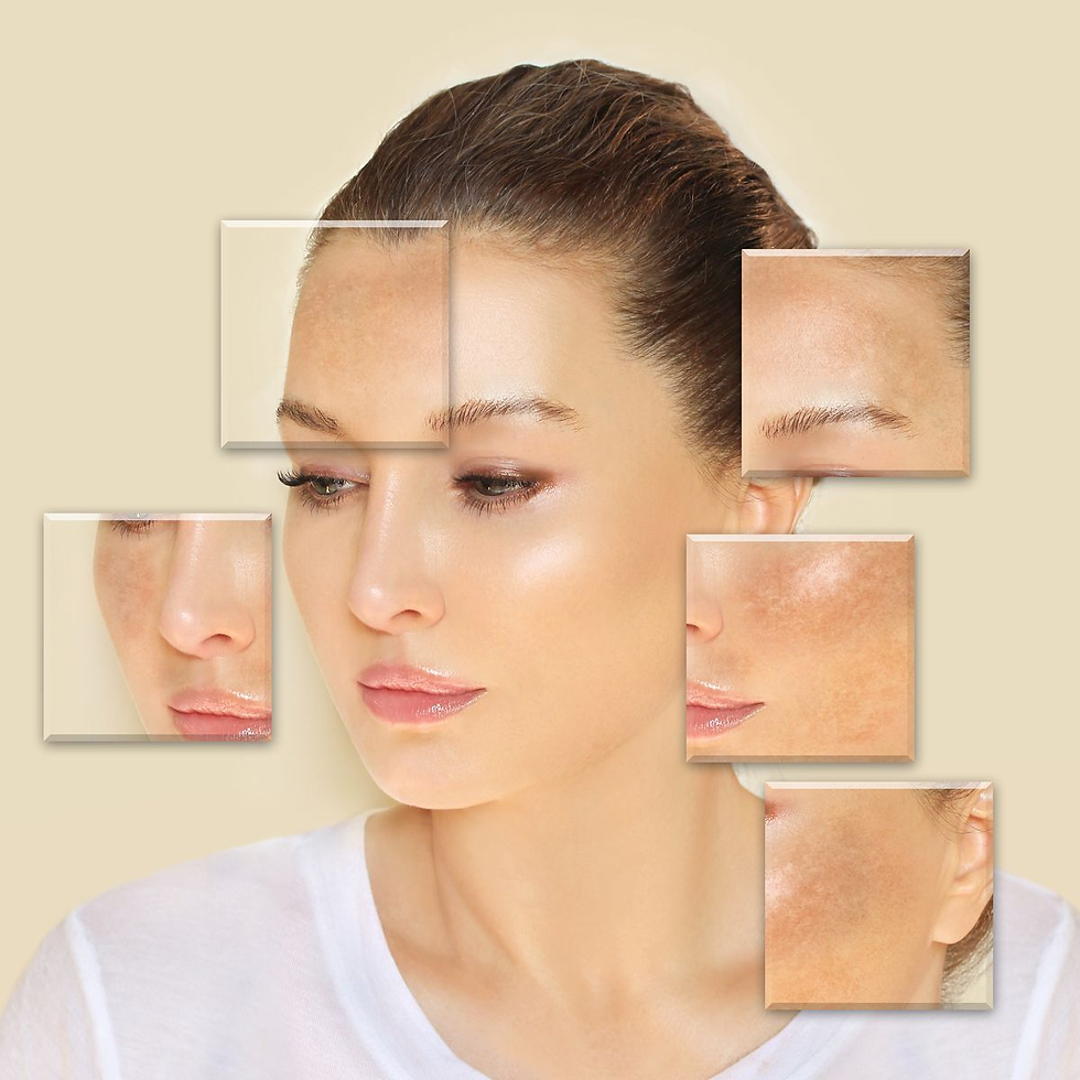 Treatment for Hyperpigmentation in Kolkata | Skincredible
