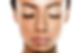 Skin bleaching