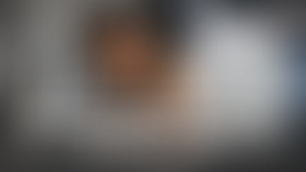 Water Conditioner vs. Water Filtration: Which Is Better for Reducing Eczema and Improving Skin Health?