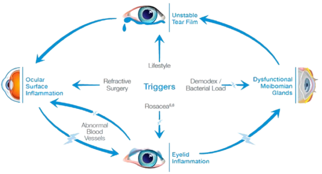 Dry Eye Inflammatory Cycle