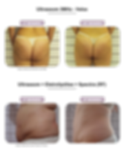 protocolos(2).png