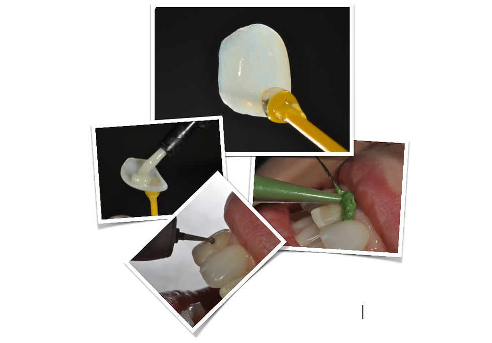 Curso de Lentes de Contato e Laminados Cerâmicos