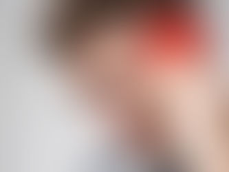 Viêm Tai Giữa Chảy Mủ Có Nên Dùng Máy Trợ Thính?