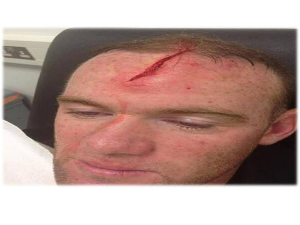 EL CORTE DE WAYNE ROONEY