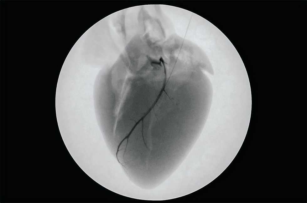 black and white heart (1)_edited.jpg