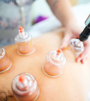 Cupping Therapy.jpg