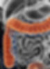 Tenacious%20Butterfly%20Colon%20Hydrothe
