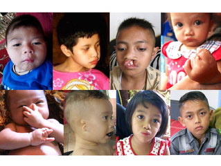 Mohon bantuan medis untuk anak-anak korban merkuri di platform Kitabisa!