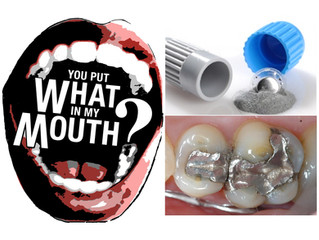 Survey Awal Pemahaman Kelompok Profesi Terhadap Dampak Penggunaan Dental Amalgam di Indonesia