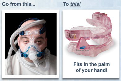 sleep-apnea.gif