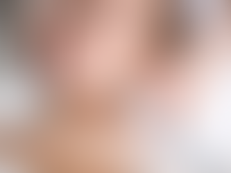 Laser Treatment for Facial Redness: Solutions for Even Skin Tone