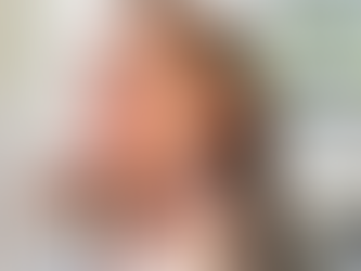 Cheek Fillers Injections Cost in Dubai: An In-Depth Guide