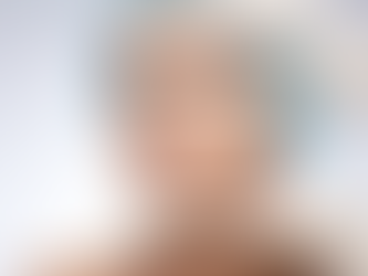 The Rise of Cosmetic Surgery: Trends, Benefits, and Considerations