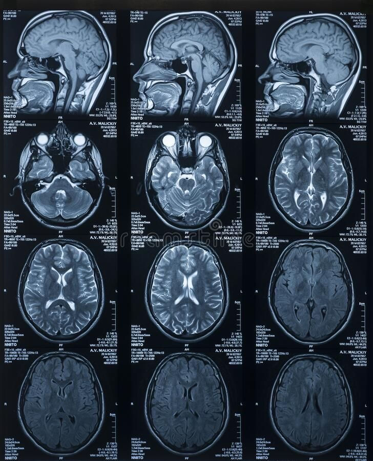 neuro.JPG