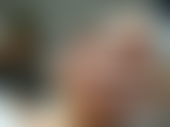 Tratamientos anti edad en Estética Baiona: resultados increíbles