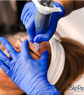 SkinPen phoenixclics.jpg