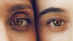 Remove Dark Circles Naturally
