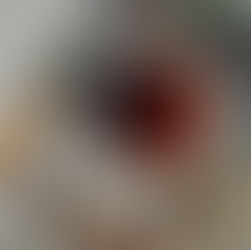 Kidney Cleanser: Remove the Stone in 3 Days
