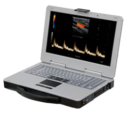 SIUI Apogee 1000 Plus Portabler Farbdoppler