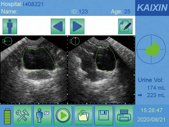 Thumbnail: KAIXIN BVT01 bladder scanner