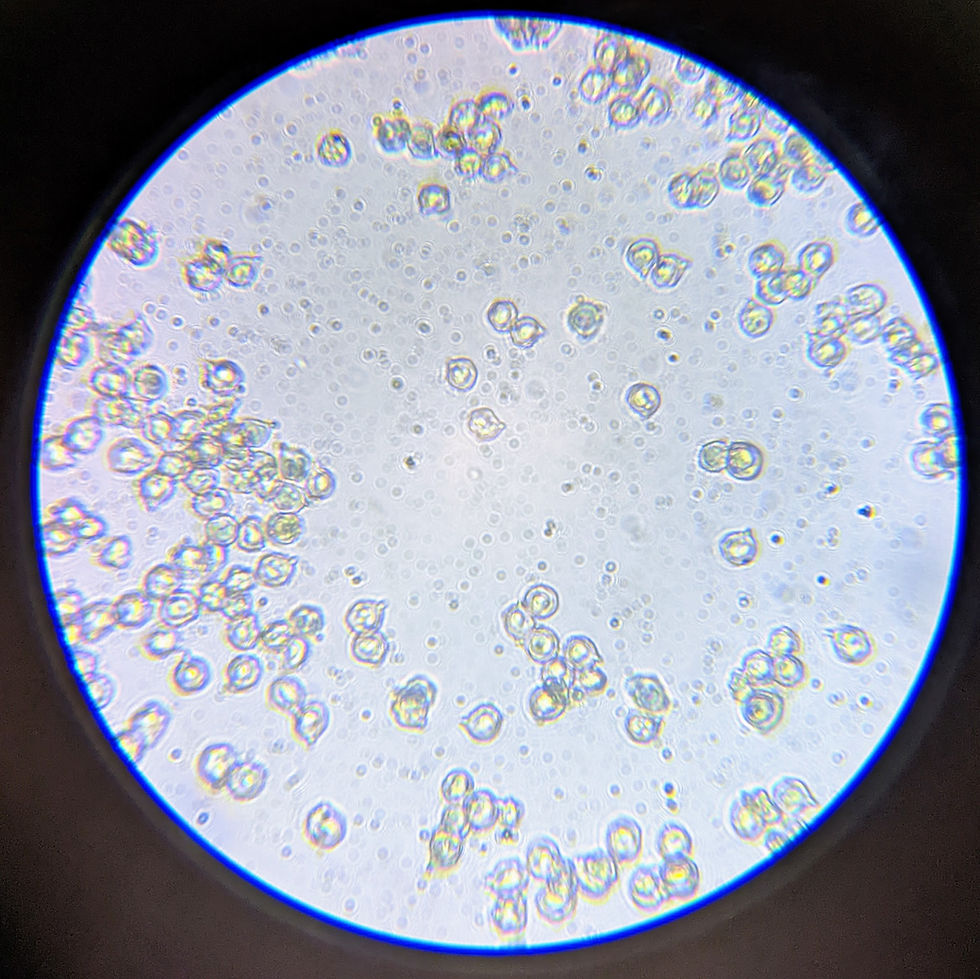 Microscope view of many translucent round mushroom spores scattered across a bright circular field, with rainbow edges.