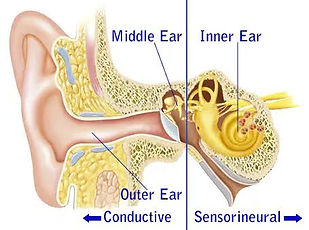 two types of hearing loss.jpg