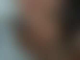 1st July - Operation day!