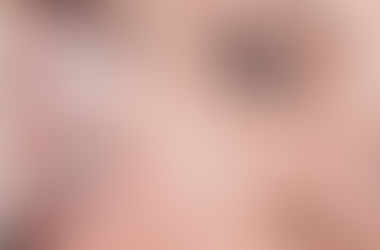 Tratamiento fácil con hielo