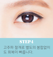 눈밑지방재배치수술방법4.png