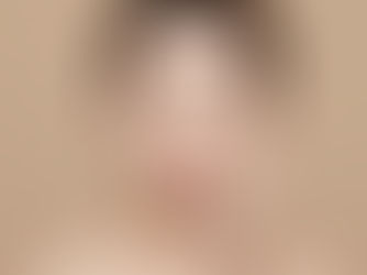 광교 더아이비 얼굴 지방이