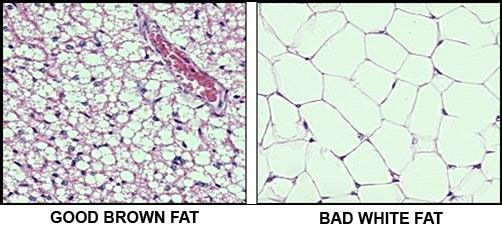Comparison between good brown fat and bad white fat cells in the human body