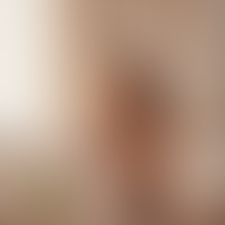 Chute de cheveux hormonale chez la femme : comprendre les causes pour mieux agir