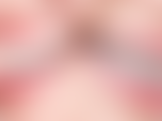 Invisalign vs. Traditional Braces: What's the Best Option for You?