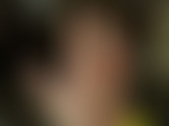 Signs & Symptoms of My AVM Bursting