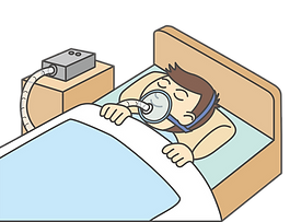 睡眠時無呼吸症候群の男性