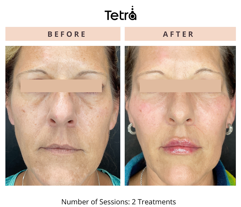 Tetra1021168123414907