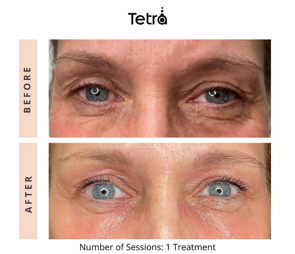 Tetra19169574152074
