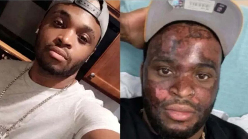 TikToker Neyo White filed suit against Diamond Facez Skin Care Bar Over