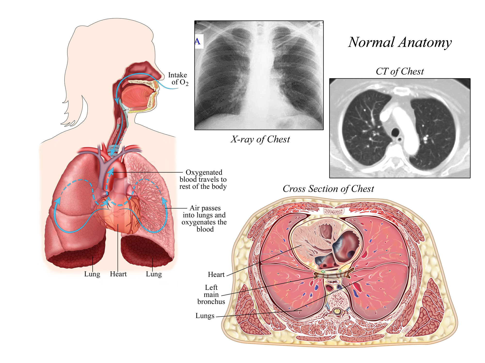 Medical Illustration