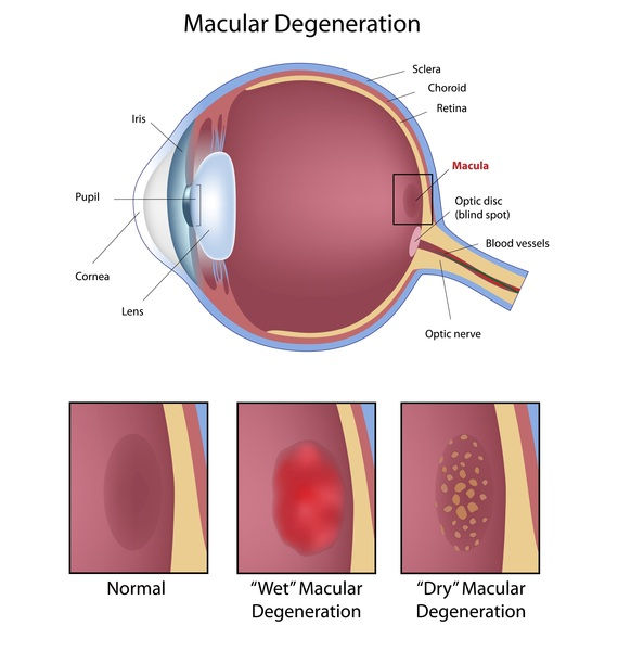 7 Ways to Protect Your Eyes from Age-Related Macular Degeneration
